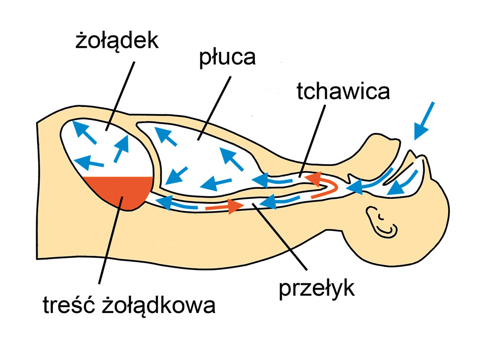 wentylacja zastepcza 04